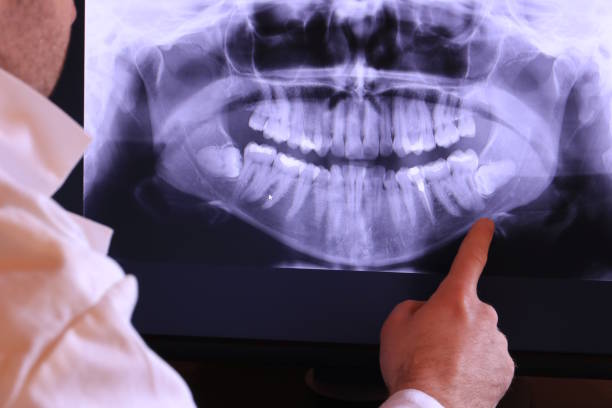 Best Pediatric Emergency Dentist in Mays Chapel, MD