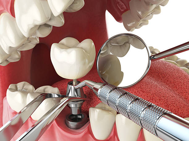 Best Emergency Cosmetic Dentistry in Mays Chapel, MD